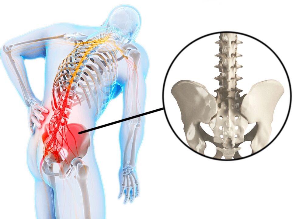 Spinal pathology is a common cause of lumbar pain