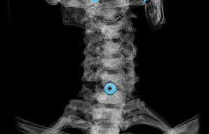 Diagnostics
