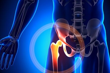 Pain in the hip joint