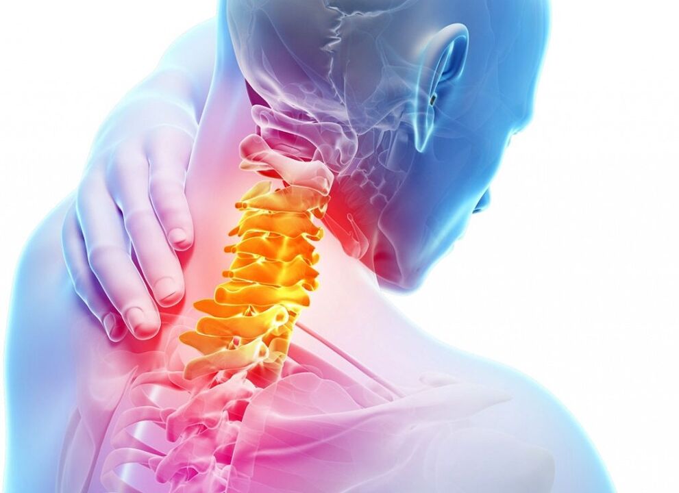 What is the cervical osteochondrosis