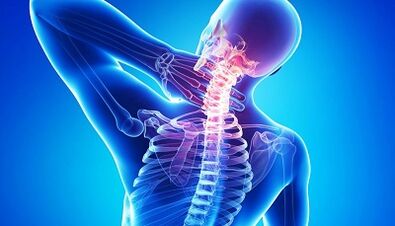 Cervical spine osteochondrosis complications