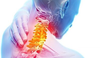 The cause of cervical osteochondrosis