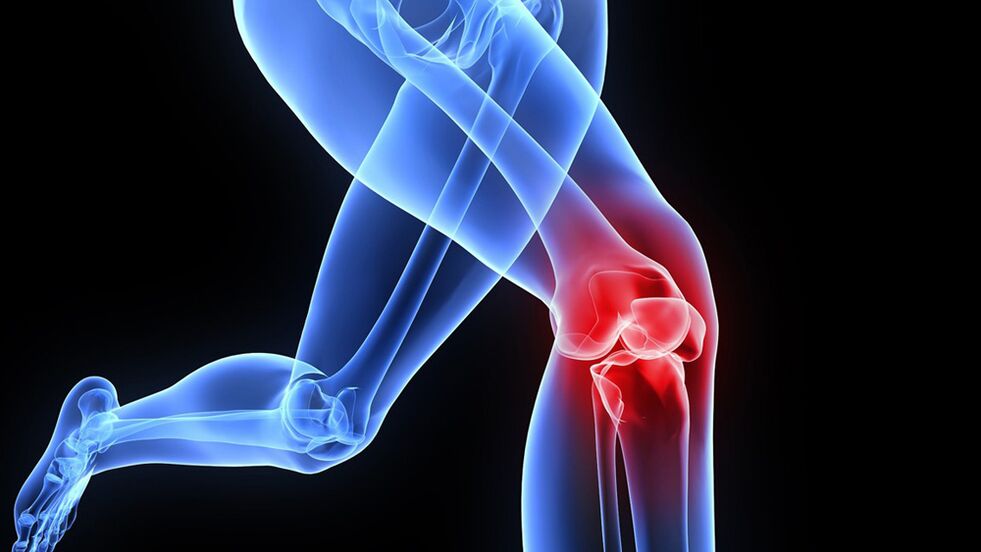 problems with knees due to arthrosis