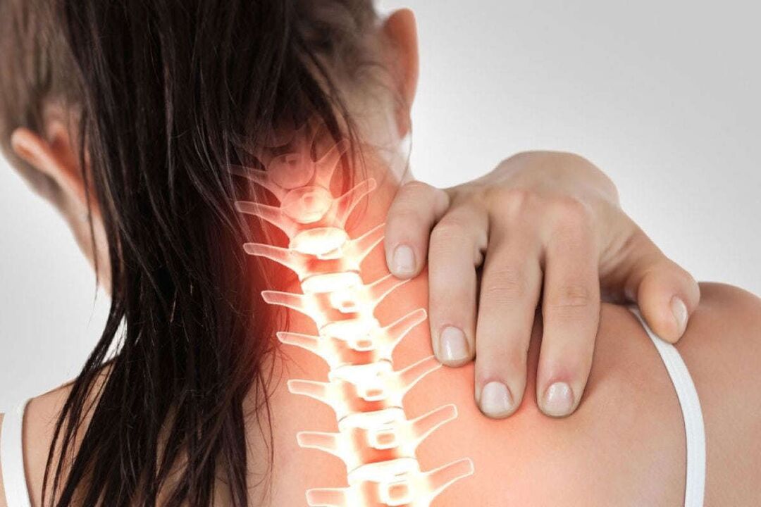 manifestation of cervical osteochondrosis